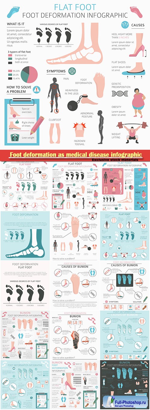 Foot deformation as medical disease infographic